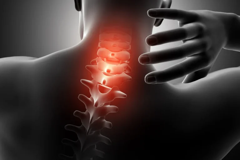 остеохондроз